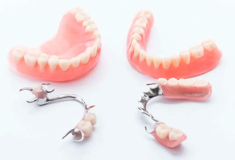 Próteses Dentárias Removíveis - Na Odonto Compass você encontra próteses dentárias removíveis e muito mais. Venha Conferir.